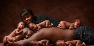 Most Unbelievable Birth Cases on Earth