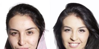 To Be Natural or Not