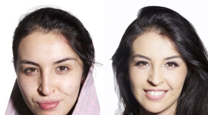 To Be Natural or Not