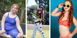 Teen Model Won’t Let Down Syndrome Stop Her From Pursuing A Modelling Career