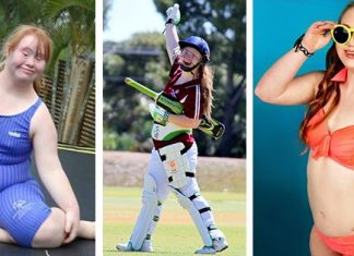 Teen Model Won’t Let Down Syndrome Stop Her From Pursuing A Modelling Career