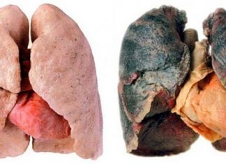 Best Natural Ways For Cleaning Your Lungs Of Nicotine And Tar