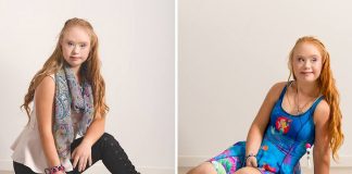 Maddy Stuart, Teen With Down Syndrome, Lands Her First Modelling Contract