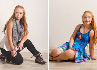 Maddy Stuart, Teen With Down Syndrome, Lands Her First Modelling Contract