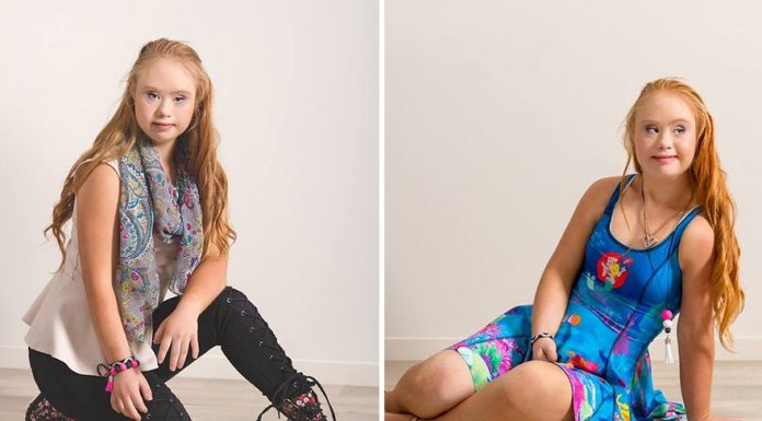 Maddy Stuart, Teen With Down Syndrome, Lands Her First Modelling Contract