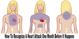 How To Recognize a Heart Attack One Month Before It Happens!