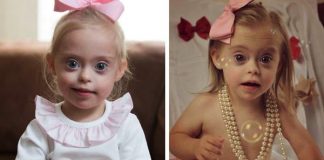 Toddler With Down Syndrome Wins TWO Modeling Contract Thanks To Her “Cheeky Smile”