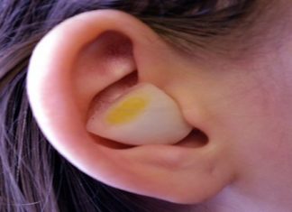 This Is What Happen When You Put Cut Up Onion Inside Your Ear