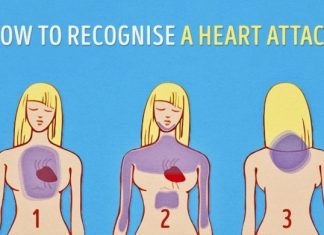 Some absolutely crucial advice: how to recognise a heart attack one month before it happens