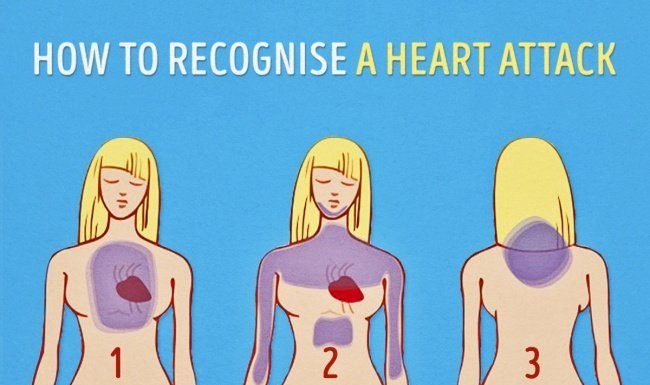 Some absolutely crucial advice: how to recognise a heart attack one month before it happens