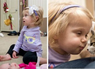 Toddler Who Lost Arm To Cancer Adopts Three-Legged Kitten To Help Recovery