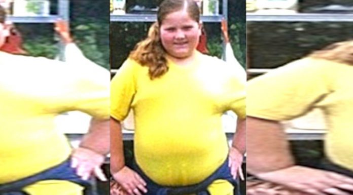 Bullies Called Her “Fatty”But When They See The 9-Year-Old’s Transformation, They Are Stunned.
