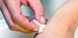 He Uses One Simple Ingredient To Help Remove His Skin Tags – The Results Are Amazing