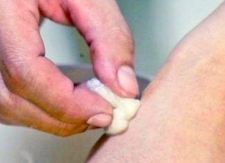 He Uses One Simple Ingredient To Help Remove His Skin Tags – The Results Are Amazing