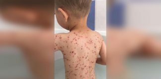 Her Son Cries With A High Fever. Then Mom Realizes The Doctor’s TERRIFYING Mistake