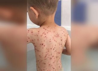 Her Son Cries With A High Fever. Then Mom Realizes The Doctor’s TERRIFYING Mistake